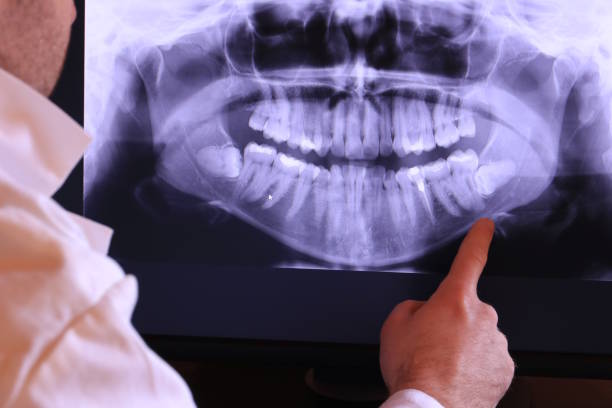 Best Dental Abscess Treatment in Hartley, CA