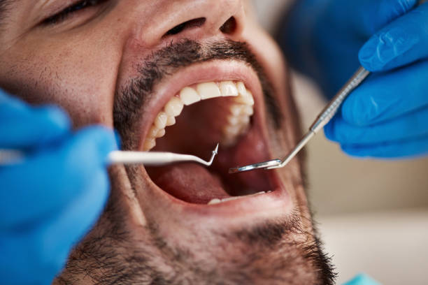 Best Emergency Treatment for Jaw Pain or Injury in Hartley, CA
